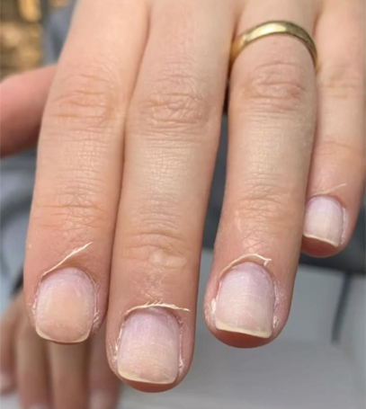 قبل کاشت ناخن